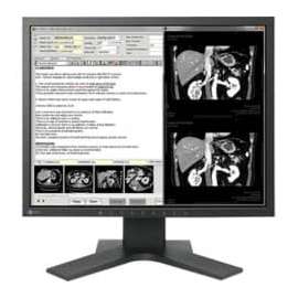 EIZO RadiForce MX194 18.9" SXGA LED LCD Monitor, 5:4, Black, 1280 x 1024, 1.07 Billion Colors