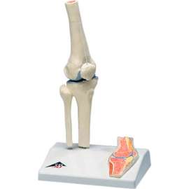 3B Anatomical Model - Mini Knee Joint with Cross Section of Bone on Base