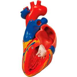 3B Anatomical Model - Heart with Bypass, 2-Part