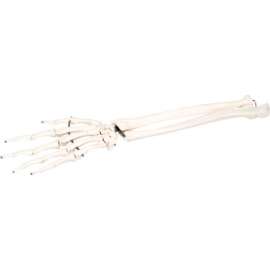 3B Anatomical Model - Loose Bones, Hand Skeleton with Ulna and Radius, Right