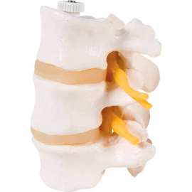 3B Anatomical Model - 3 Lumbar Vertebrae, Flexibly Mounted