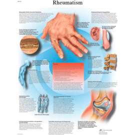 3B Anatomical Chart - Rheumatic Diseases, Paper