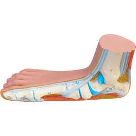 3B Anatomical Model - Flat Foot (Pes Panus)