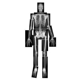 Roylco True to Life Human X-Ray Set, 18/Pack